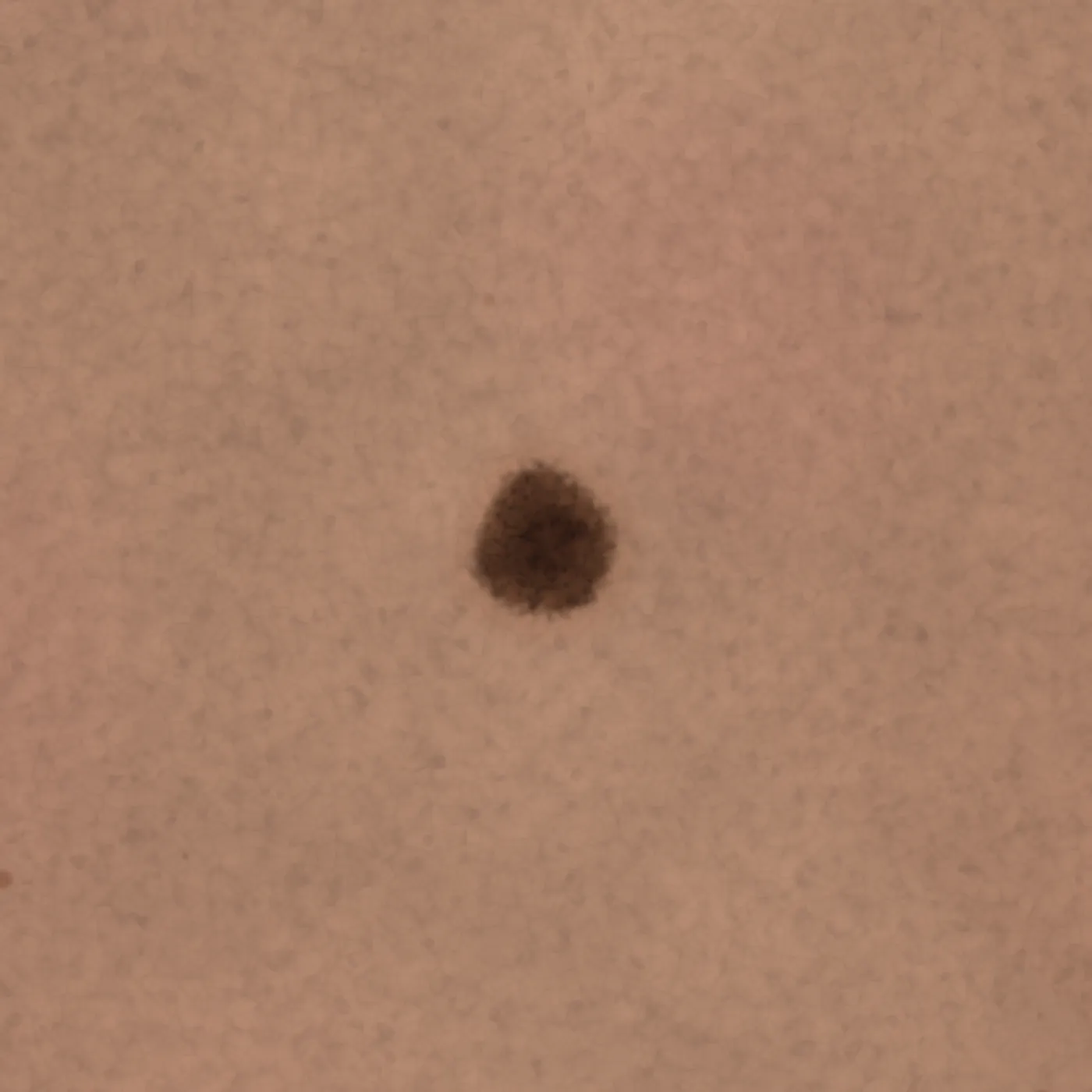 A spot at close range. Synthetic, like every image on this page.