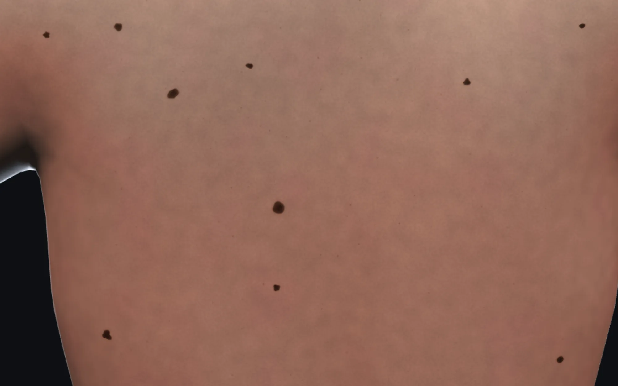 Two visits of the same back, warped into register. One spot near the middle, ringed in red, appears only at the later visit.